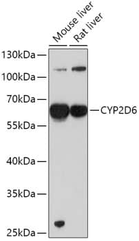 Western Blot: Cytochrome P450 2D6 Antibody [NBP3-35296] - Western blot analysis of various lysates using Cytochrome P450 2D6 Rabbit pAb at 1:1000 dilution.Secondary antibody: HRP-conjugated Goat anti-Rabbit IgG (H+L) at 1:10000 dilution.Lysates/proteins: 25ug per lane.Blocking buffer: 3% nonfat dry milk in TBST.Detection: ECL Basic Kit.Exposure time: 90s.