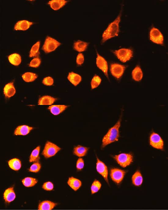 Immunocytochemistry/ Immunofluorescence: GBP2 Antibody [NBP3-35297] - Immunofluorescence analysis of L929 cells using GBP2 Rabbit pAb at dilution of 1:100 (40x lens). Secondary antibody: Cy3-conjugated Goat anti-Rabbit IgG (H+L) at 1:500 dilution. Blue: DAPI for nuclear staining.