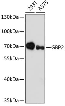 Western Blot GBP2 Antibody