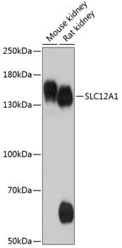 Western Blot: NKCC2/SLC12A1 Antibody [NBP3-35298] - Western blot analysis of various lysates using NKCC2/SLC12A1 Rabbit pAb at 1:1000 dilution.Secondary antibody: HRP-conjugated Goat anti-Rabbit IgG (H+L) at 1:10000 dilution.Lysates/proteins: 25ug per lane.Blocking buffer: 3% nonfat dry milk in TBST.Detection: ECL Basic Kit.Exposure time: 90s.