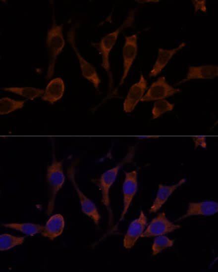 Immunocytochemistry/ Immunofluorescence: RPL32 Antibody [NBP3-35299] - Immunofluorescence analysis of L929 cells using RPL32 Rabbit pAb at dilution of 1:100 (40x lens). Secondary antibody: Cy3-conjugated Goat anti-Rabbit IgG (H+L) at 1:500 dilution. Blue: DAPI for nuclear staining.