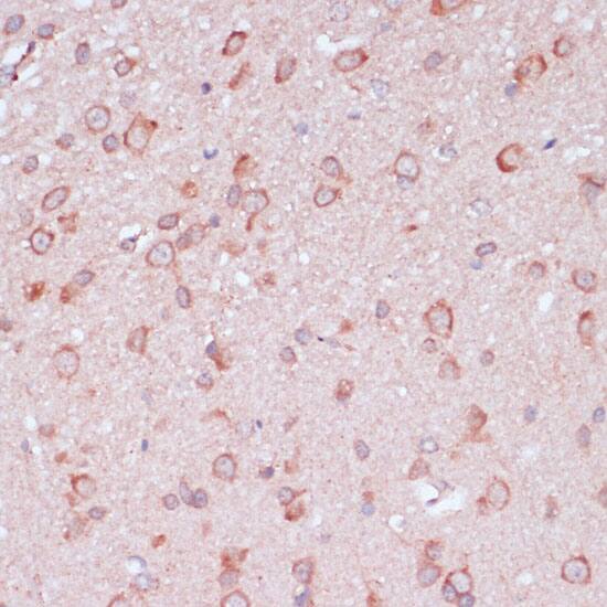 Immunohistochemistry: RPL32 Antibody [NBP3-35299] - Immunohistochemistry analysis of paraffin-embedded Rat brain using RPL32 Rabbit pAb at dilution of 1:100 (40x lens). Microwave antigen retrieval performed with 0.01M PBS Buffer (pH 7.2) prior to IHC staining.