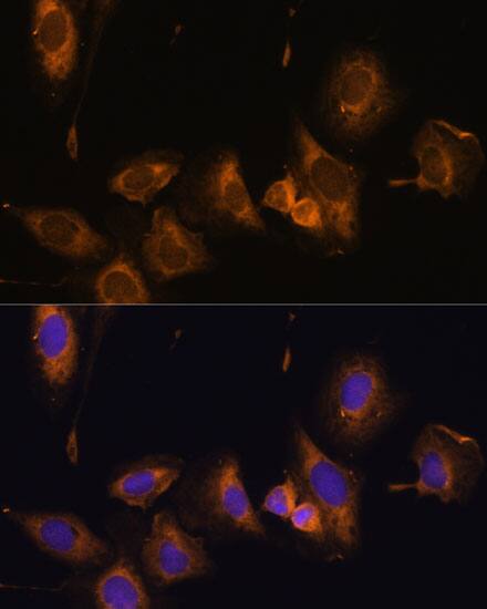 Immunocytochemistry/ Immunofluorescence: RPL32 Antibody [NBP3-35299] - Immunofluorescence analysis of U-2 OS cells using RPL32 Rabbit pAb at dilution of 1:100 (40x lens). Secondary antibody: Cy3-conjugated Goat anti-Rabbit IgG (H+L) at 1:500 dilution. Blue: DAPI for nuclear staining.