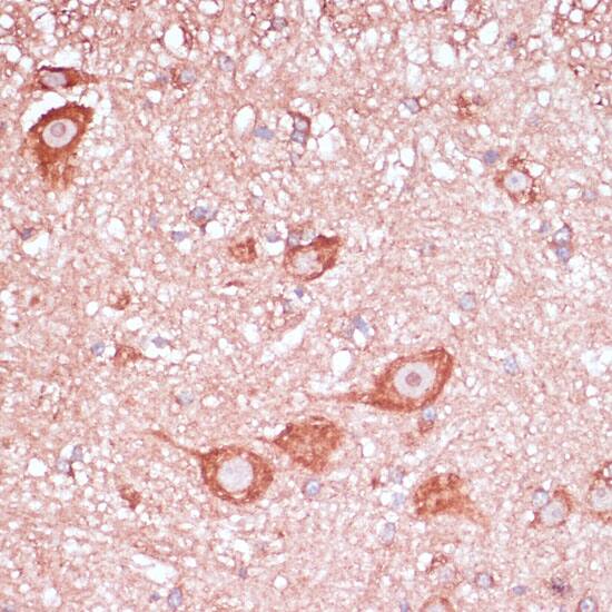 Immunohistochemistry: RPL32 Antibody [NBP3-35299] - Immunohistochemistry analysis of paraffin-embedded Mouse spinal cord using RPL32 Rabbit pAb at dilution of 1:100 (40x lens). Microwave antigen retrieval performed with 0.01M PBS Buffer (pH 7.2) prior to IHC staining.