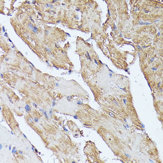 Immunohistochemistry: Histidase Antibody [NBP3-35300] - Immunohistochemistry analysis of paraffin-embedded Mouse heart using Histidase Rabbit pAb at dilution of 1:100 (40x lens). Microwave antigen retrieval performed with 0.01M PBS Buffer (pH 7.2) prior to IHC staining.