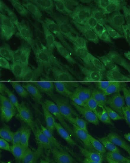 Immunocytochemistry/ Immunofluorescence Histidase Antibody