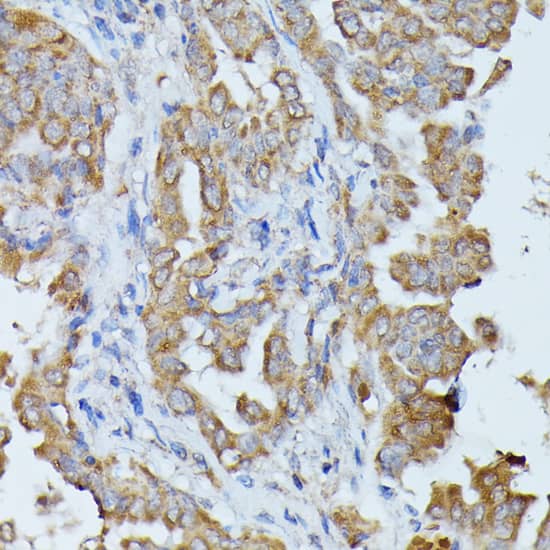 Immunohistochemistry Histidase Antibody