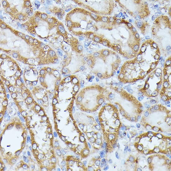 Immunohistochemistry: Histidase Antibody [NBP3-35300] - Immunohistochemistry analysis of paraffin-embedded Rat kidney using Histidase Rabbit pAb at dilution of 1:100 (40x lens). Microwave antigen retrieval performed with 0.01M PBS Buffer (pH 7.2) prior to IHC staining.