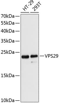 Western Blot: VPS29 Antibody [NBP3-35309] - Western blot analysis of various lysates using VPS29 Rabbit pAb at 1:3000 dilution.Secondary antibody: HRP-conjugated Goat anti-Rabbit IgG (H+L) at 1:10000 dilution.Lysates/proteins: 25ug per lane.Blocking buffer: 3% nonfat dry milk in TBST.Detection: ECL Basic Kit.Exposure time: 90s.