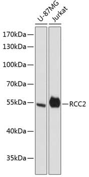 Western Blot: RCC2 Antibody [NBP3-35311] - Western blot analysis of various lysates using RCC2 Rabbit pAb at 1:3000 dilution.Secondary antibody: HRP-conjugated Goat anti-Rabbit IgG (H+L) at 1:10000 dilution.Lysates/proteins: 25ug per lane.Blocking buffer: 3% nonfat dry milk in TBST.Detection: ECL Basic Kit.Exposure time: 90s.