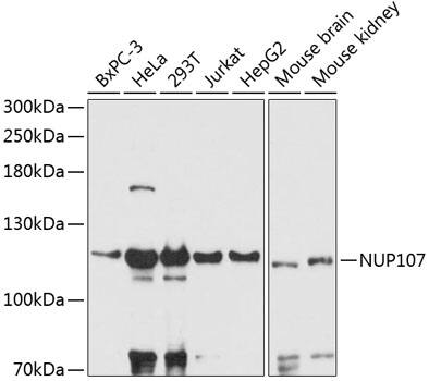 Western Blot: Nucleoporin 107 Antibody [NBP3-35312] - Western blot analysis of various lysates using Nucleoporin 107 Rabbit pAb at 1:3000 dilution.Secondary antibody: HRP-conjugated Goat anti-Rabbit IgG (H+L) at 1:10000 dilution.Lysates/proteins: 25ug per lane.Blocking buffer: 3% nonfat dry milk in TBST.Detection: ECL Basic Kit.Exposure time: 30s.