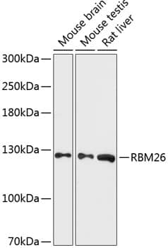 Western Blot: RBM26 Antibody [NBP3-35313] - Western blot analysis of various lysates using RBM26 Rabbit pAb at 1:3000 dilution.Secondary antibody: HRP-conjugated Goat anti-Rabbit IgG (H+L) at 1:10000 dilution.Lysates/proteins: 25ug per lane.Blocking buffer: 3% nonfat dry milk in TBST.Detection: ECL Basic Kit.Exposure time: 90s.