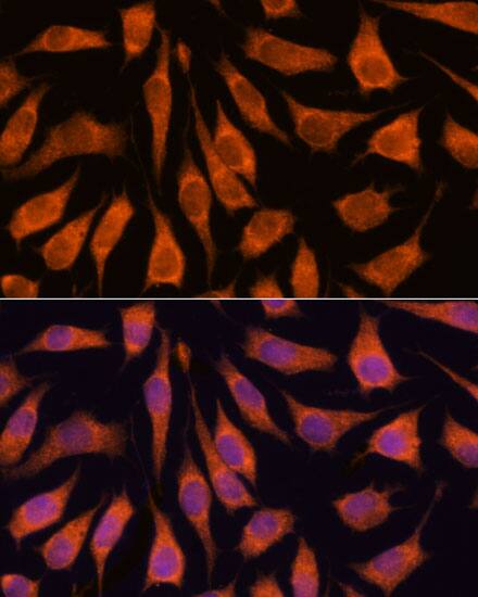 Immunocytochemistry/ Immunofluorescence: GOLPH3 Antibody [NBP3-35314] - Immunofluorescence analysis of L929 cells using GOLPH3 Rabbit pAb at dilution of 1:100. Secondary antibody: Cy3-conjugated Goat anti-Rabbit IgG (H+L) at 1:500 dilution. Blue: DAPI for nuclear staining.