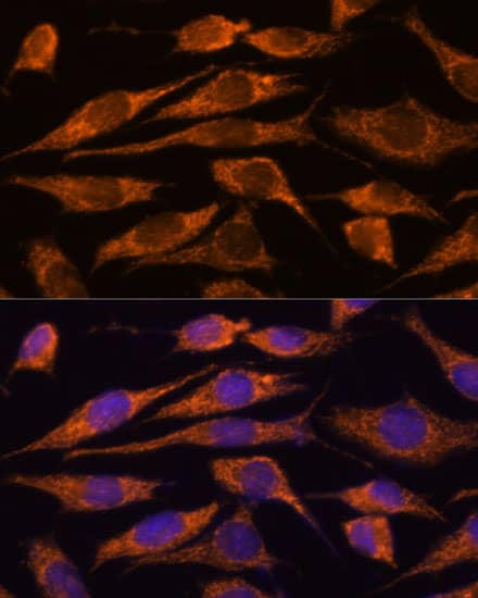 Immunocytochemistry/ Immunofluorescence: MTMR9 Antibody [NBP3-35315] - Immunofluorescence analysis of L929 cells using MTMR9 Rabbit pAb at dilution of 1:100. Secondary antibody: Cy3-conjugated Goat anti-Rabbit IgG (H+L) at 1:500 dilution. Blue: DAPI for nuclear staining.