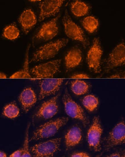 Immunocytochemistry/ Immunofluorescence: MTMR9 Antibody [NBP3-35315] - Immunofluorescence analysis of HeLa cells using MTMR9 Rabbit pAb at dilution of 1:100. Secondary antibody: Cy3-conjugated Goat anti-Rabbit IgG (H+L) at 1:500 dilution. Blue: DAPI for nuclear staining.