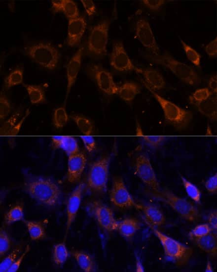 Immunocytochemistry/ Immunofluorescence: VPS25 Antibody [NBP3-35316] - Immunofluorescence analysis of NIH-3T3 cells using VPS25 Rabbit pAb at dilution of 1:100 (40x lens). Secondary antibody: Cy3-conjugated Goat anti-Rabbit IgG (H+L) at 1:500 dilution. Blue: DAPI for nuclear staining.