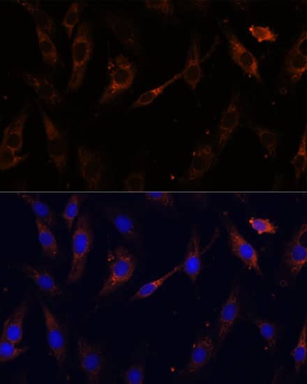 Immunocytochemistry/ Immunofluorescence: VPS25 Antibody [NBP3-35316] - Immunofluorescence analysis of C6 cells using VPS25 Rabbit pAb at dilution of 1:100 (40x lens). Secondary antibody: Cy3-conjugated Goat anti-Rabbit IgG (H+L) at 1:500 dilution. Blue: DAPI for nuclear staining.