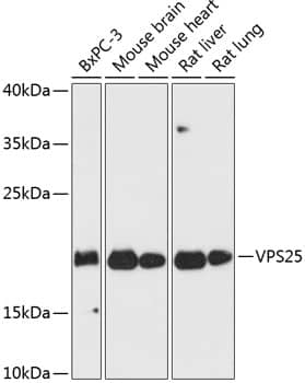 Western Blot: VPS25 Antibody [NBP3-35316] - Western blot analysis of various lysates using VPS25 Rabbit pAb at 1:3000 dilution.Secondary antibody: HRP-conjugated Goat anti-Rabbit IgG (H+L) at 1:10000 dilution.Lysates/proteins: 25ug per lane.Blocking buffer: 3% nonfat dry milk in TBST.Detection: ECL Basic Kit.Exposure time: 30s.