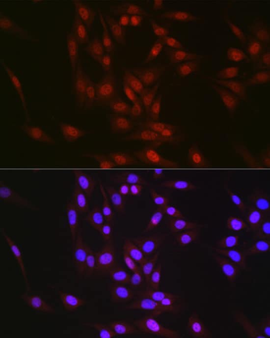 Immunocytochemistry/ Immunofluorescence: RBM14 Antibody [NBP3-35319] - Immunofluorescence analysis of NIH/3T3 cells using RBM14 Rabbit pAb at dilution of 1:300 (40x lens). Secondary antibody: Cy3-conjugated Goat anti-Rabbit IgG (H+L) at 1:500 dilution. Blue: DAPI for nuclear staining.