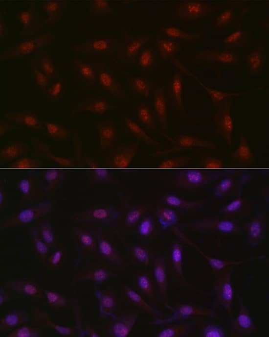 Immunocytochemistry/ Immunofluorescence: RBM14 Antibody [NBP3-35319] - Immunofluorescence analysis of U2OS cells using RBM14 Rabbit pAb at dilution of 1:300 (40x lens). Secondary antibody: Cy3-conjugated Goat anti-Rabbit IgG (H+L) at 1:500 dilution. Blue: DAPI for nuclear staining.