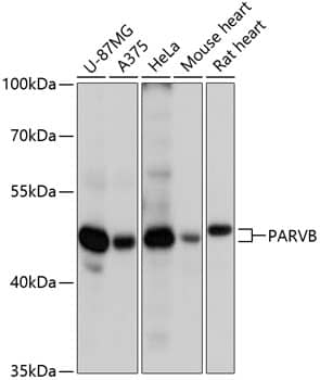 Western Blot: PARVB Antibody [NBP3-35320] - Western blot analysis of various lysates using PARVB Rabbit pAb at 1:3000 dilution.Secondary antibody: HRP-conjugated Goat anti-Rabbit IgG (H+L) at 1:10000 dilution.Lysates/proteins: 25ug per lane.Blocking buffer: 3% nonfat dry milk in TBST.Detection: ECL Basic Kit.Exposure time: 90s.