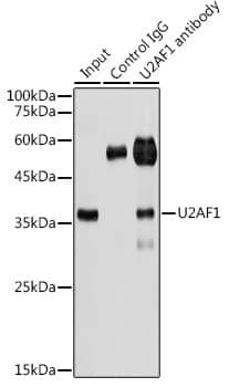 Immunoprecipitation: U2AF35 Antibody [NBP3-35321] - Immunoprecipitation analysis of 300 ug extracts of HeLa cells using 3 ug U2AF35 antibody. Western blot was performed from the immunoprecipitate using U2AF35 antibody at a dilution of 1:1000.