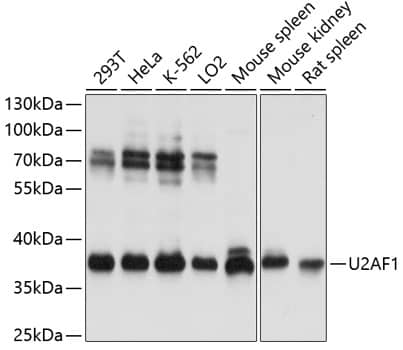 Western Blot: U2AF35 Antibody [NBP3-35321] - Western blot analysis of various lysates using U2AF35 Rabbit pAb at 1:3000 dilution.Secondary antibody: HRP-conjugated Goat anti-Rabbit IgG (H+L) at 1:10000 dilution.Lysates/proteins: 25ug per lane.Blocking buffer: 3% nonfat dry milk in TBST.Detection: ECL Basic Kit.Exposure time: 3s.