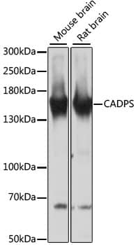 Western Blot: CADPS Antibody [NBP3-35322] - Western blot analysis of various lysates using CADPS Rabbit pAb at 1:3000 dilution.Secondary antibody: HRP-conjugated Goat anti-Rabbit IgG (H+L) at 1:10000 dilution.Lysates/proteins: 25ug per lane.Blocking buffer: 3% nonfat dry milk in TBST.Detection: ECL Basic Kit.Exposure time: 30s.