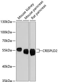 Western Blot: CRISPLD2 Antibody [NBP3-35323] - Western blot analysis of various lysates using CRISPLD2 Rabbit pAb at 1:3000 dilution.Secondary antibody: HRP-conjugated Goat anti-Rabbit IgG (H+L) at 1:10000 dilution.Lysates/proteins: 25ug per lane.Blocking buffer: 3% nonfat dry milk in TBST.Detection: ECL Enhanced Kit.Exposure time: 90s.