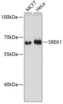 Western Blot: SFRS12 Antibody [NBP3-35325] - Western blot analysis of various lysates using SFRS12 Rabbit pAb at 1:3000 dilution.Secondary antibody: HRP-conjugated Goat anti-Rabbit IgG (H+L) at 1:10000 dilution.Lysates/proteins: 25ug per lane.Blocking buffer: 3% nonfat dry milk in TBST.Detection: ECL Basic Kit.Exposure time: 90s.