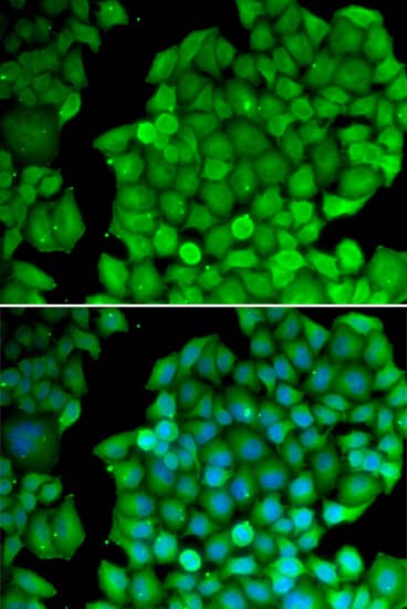 Immunocytochemistry/ Immunofluorescence: Cyclin D2 Antibody [NBP3-35328] - Immunofluorescence analysis of U2OS cells using Cyclin D2 Rabbit pAb. Secondary antibody: Cy3-conjugated Goat anti-Rabbit IgG (H+L) at 1:500 dilution. Blue: DAPI for nuclear staining.