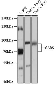 Western Blot GARS Antibody