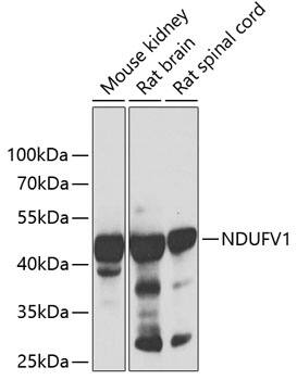 Western Blot: NDUFV1 Antibody [NBP3-35332] - Western blot analysis of various lysates using NDUFV1 Rabbit pAb at 1:1000 dilution.Secondary antibody: HRP-conjugated Goat anti-Rabbit IgG (H+L) at 1:10000 dilution.Lysates/proteins: 25ug per lane.Blocking buffer: 3% nonfat dry milk in TBST.Detection: ECL Basic Kit.Exposure time: 90s.
