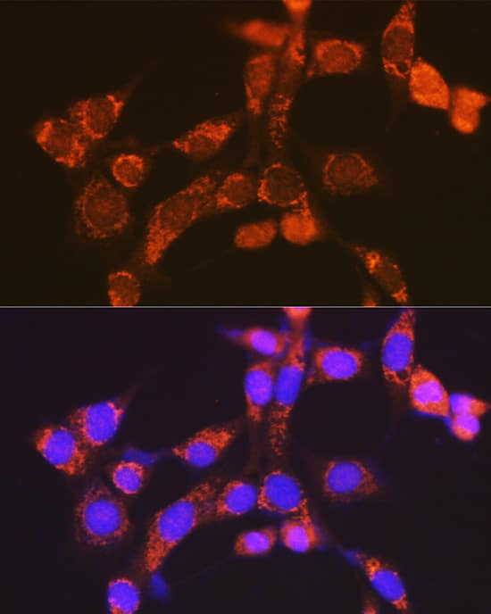 Immunocytochemistry/ Immunofluorescence: NDUFV1 Antibody [NBP3-35332] - Immunofluorescence analysis of NIH-3T3 cells using NDUFV1 Rabbit pAb at dilution of 1:100 (40x lens). Secondary antibody: Cy3-conjugated Goat anti-Rabbit IgG (H+L) at 1:500 dilution. Blue: DAPI for nuclear staining.