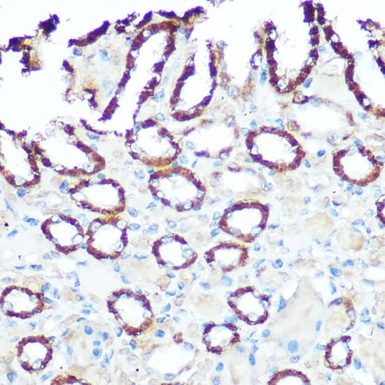 Immunohistochemistry: NDUFV1 Antibody [NBP3-35332] - Immunohistochemistry analysis of paraffin-embedded Rat kidney using NDUFV1 Rabbit pAb at dilution of 1:100 (40x lens). Microwave antigen retrieval performed with 0.01M Tris/EDTA Buffer (pH 9.0) prior to IHC staining.