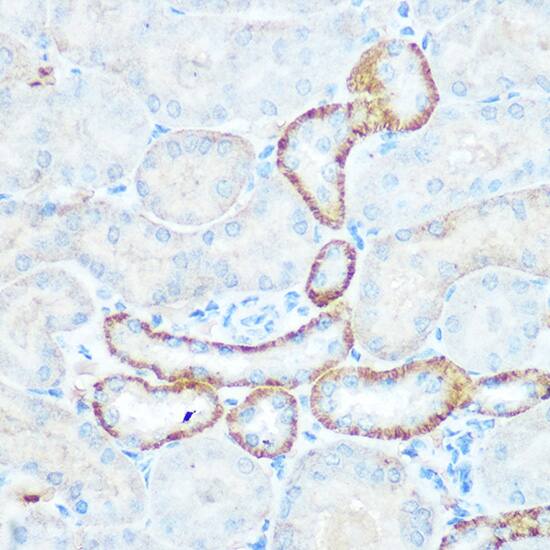 Immunohistochemistry: NDUFV1 Antibody [NBP3-35332] - Immunohistochemistry analysis of paraffin-embedded Mouse kidney using NDUFV1 Rabbit pAb at dilution of 1:100 (40x lens). Microwave antigen retrieval performed with 0.01M Tris/EDTA Buffer (pH 9.0) prior to IHC staining.
