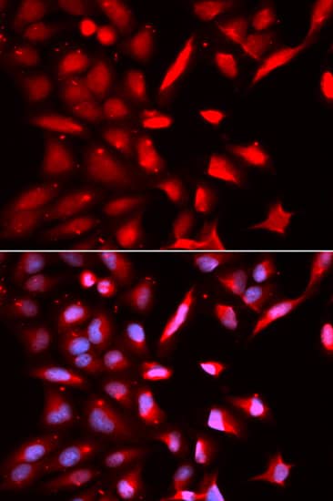 Immunocytochemistry/ Immunofluorescence: PSMC3 Antibody [NBP3-35333] - Immunofluorescence analysis of U2OS cells using PSMC3 Rabbit pAb. Secondary antibody: Cy3-conjugated Goat anti-Rabbit IgG (H+L) at 1:500 dilution. Blue: DAPI for nuclear staining.