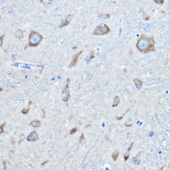 Immunohistochemistry: Seryl tRNA synthetase Antibody [NBP3-35334] - Immunohistochemistry analysis of paraffin-embedded Mouse spinal cord using Seryl tRNA synthetase Rabbit pAb at dilution of 1:100 (40x lens). High pressure antigen retrieval performed with 0.01M Citrate Bufferr (pH 6.0) prior to IHC staining.