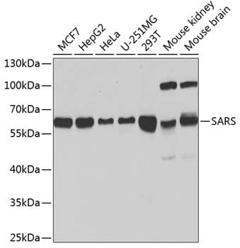 Western Blot: Seryl tRNA synthetase Antibody [NBP3-35334] - Western blot analysis of various lysates using Seryl tRNA synthetase Rabbit pAb at 1:1000 dilution.Secondary antibody: HRP-conjugated Goat anti-Rabbit IgG (H+L) at 1:10000 dilution.Lysates/proteins: 25ug per lane.Blocking buffer: 3% nonfat dry milk in TBST.Detection: ECL Basic Kit.Exposure time: 90s.