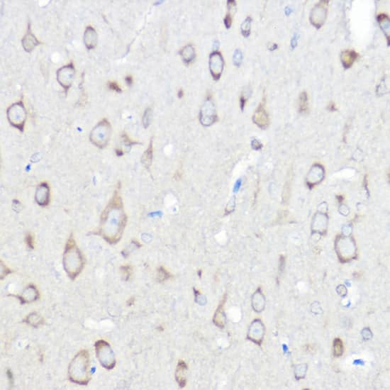 Immunohistochemistry: Seryl tRNA synthetase Antibody [NBP3-35334] - Immunohistochemistry analysis of paraffin-embedded Rat brain using Seryl tRNA synthetase Rabbit pAb at dilution of 1:100 (40x lens). High pressure antigen retrieval performed with 0.01M Citrate Bufferr (pH 6.0) prior to IHC staining.