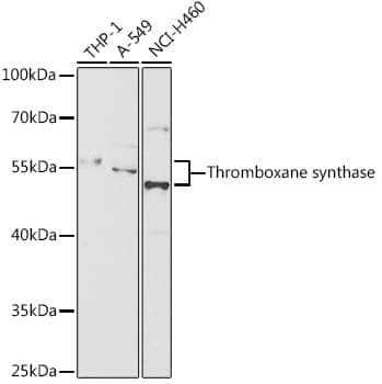 Western Blot: Thromboxane synthase Antibody [NBP3-35335] - Western blot analysis of various lysates using Thromboxane synthase Rabbit pAb at 1:1000 dilution.Secondary antibody: HRP-conjugated Goat anti-Rabbit IgG (H+L) at 1:10000 dilution.Lysates/proteins: 25ug per lane.Blocking buffer: 3% nonfat dry milk in TBST.Detection: ECL Basic Kit.Exposure time: 60s.