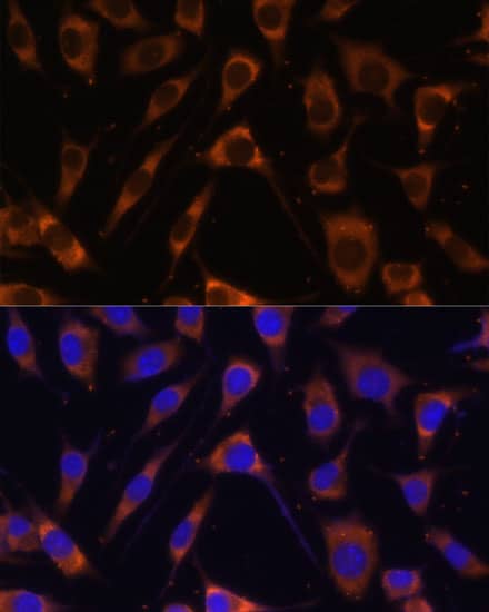 Immunocytochemistry/ Immunofluorescence: Laminin beta 1 Antibody [NBP3-35336] - Immunofluorescence analysis of L929 cells using Laminin beta 1 Rabbit pAb at dilution of 1:100 (40x lens). Secondary antibody: Cy3-conjugated Goat anti-Rabbit IgG (H+L) at 1:500 dilution. Blue: DAPI for nuclear staining.