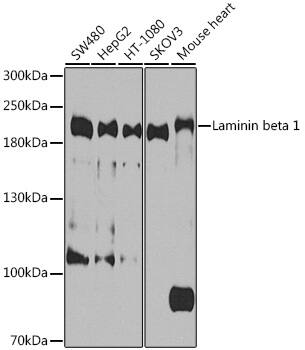 Western Blot: Laminin beta 1 Antibody [NBP3-35336] - Western blot analysis of various lysates using Laminin beta 1 Rabbit pAb at 1:1000 dilution.Secondary antibody: HRP-conjugated Goat anti-Rabbit IgG (H+L) at 1:10000 dilution.Lysates/proteins: 25ug per lane.Blocking buffer: 3% nonfat dry milk in TBST.Detection: ECL Basic Kit.Exposure time: 10s.