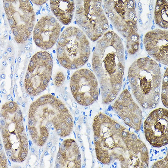 Immunohistochemistry: TCP1 alpha Antibody [NBP3-35337] - Immunohistochemistry analysis of paraffin-embedded Mouse kidney using TCP1 alpha Rabbit pAb at dilution of 1:100 (40x lens). High pressure antigen retrieval performed with 0.01M Citrate Bufferr (pH 6.0) prior to IHC staining.