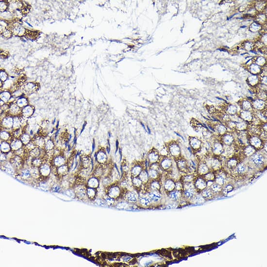 Immunohistochemistry: TCP1 alpha Antibody [NBP3-35337] - Immunohistochemistry analysis of paraffin-embedded Rat testis using TCP1 alpha Rabbit pAb at dilution of 1:100 (40x lens). High pressure antigen retrieval performed with 0.01M Citrate Bufferr (pH 6.0) prior to IHC staining.