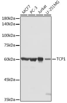 Western Blot: TCP1 alpha Antibody [NBP3-35337] - Western blot analysis of various lysates using TCP1 alpha Rabbit pAb at 1:1000 dilution.Secondary antibody: HRP-conjugated Goat anti-Rabbit IgG (H+L) at 1:10000 dilution.Lysates/proteins: 25ug per lane.Blocking buffer: 3% nonfat dry milk in TBST.Detection: ECL Basic Kit.Exposure time: 5s.