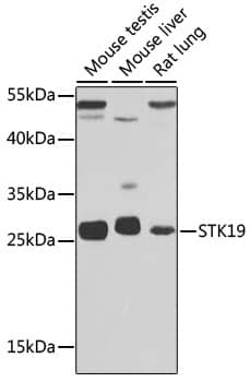 Western Blot STK19 Antibody - BSA Free
