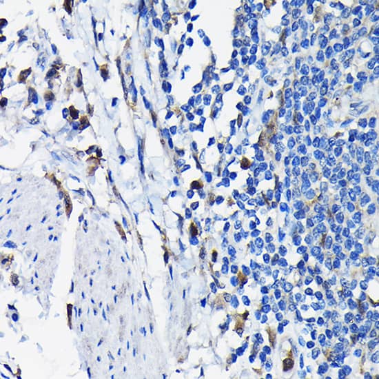 Immunohistochemistry STK19 Antibody - BSA Free