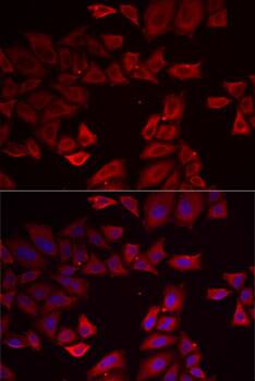 Immunocytochemistry/ Immunofluorescence: SEPHS1 Antibody [NBP3-35339] - Immunofluorescence analysis of MCF7 cells using [KO Validated] SEPHS1 Rabbit pAb at 1:500 dilution. Blue: DAPI for nuclear staining.