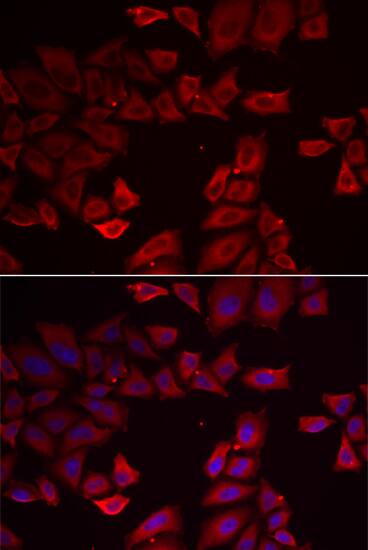 Immunocytochemistry/ Immunofluorescence: SEPHS1 Antibody [NBP3-35339] - Immunofluorescence analysis of HeLa cells using SEPHS1 Rabbit pAb at 1:500 dilution. Blue: DAPI for nuclear staining.